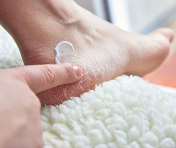 Hand Fuss Syndrom Behandlung